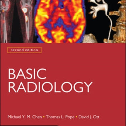 Basic Radiology Second Edition