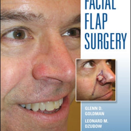 Facial Flaps Surgery