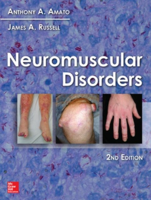 Neuromuscular Disorders