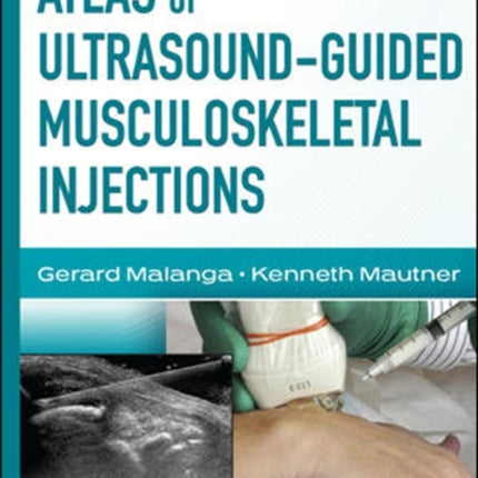 Atlas of Ultrasound-Guided Musculoskeletal Injections