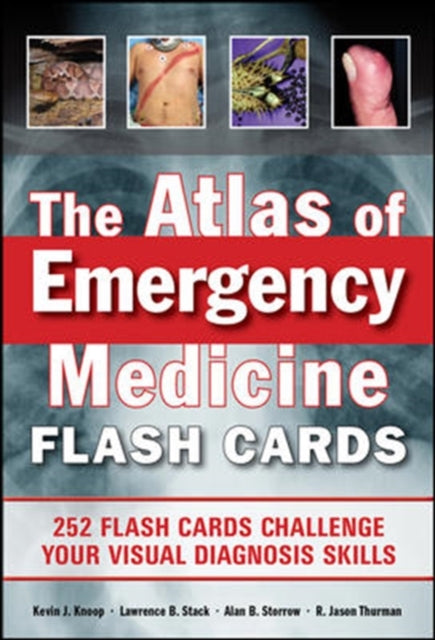 The Atlas of Emergency Medicine Flashcards