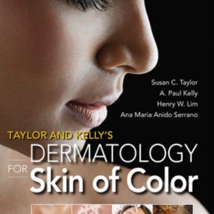 Taylor and Kelly's Dermatology for Skin of Color 2/E