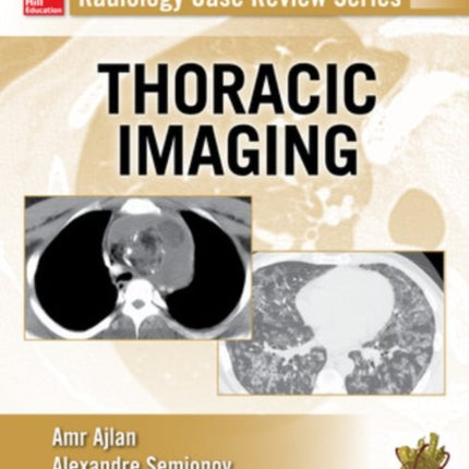 Radiology Case Review Series: Thoracic Imaging