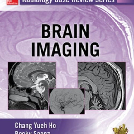 Radiology Case Review Series: Brain Imaging