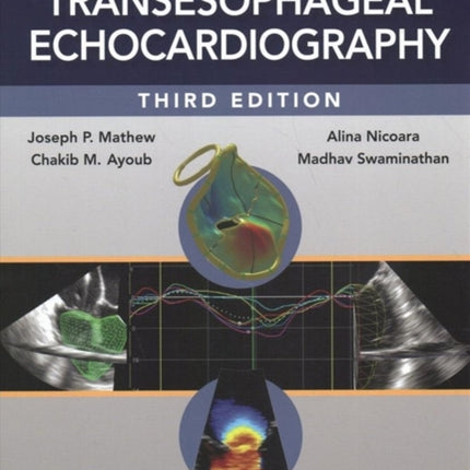 Clinical Manual and Review of Transesophageal Echocardiography, 3/e