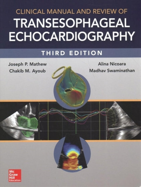 Clinical Manual and Review of Transesophageal Echocardiography, 3/e