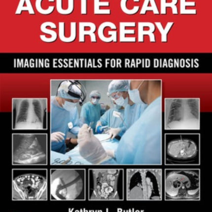 Acute Care Surgery: Imaging Essentials for Rapid Diagnosis