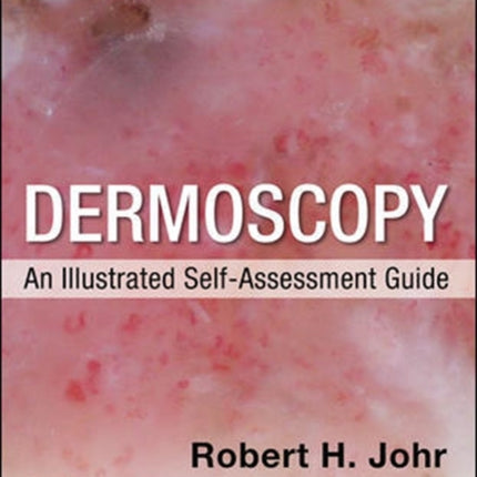 Dermoscopy: An Illustrated Self-Assessment Guide, 2/e