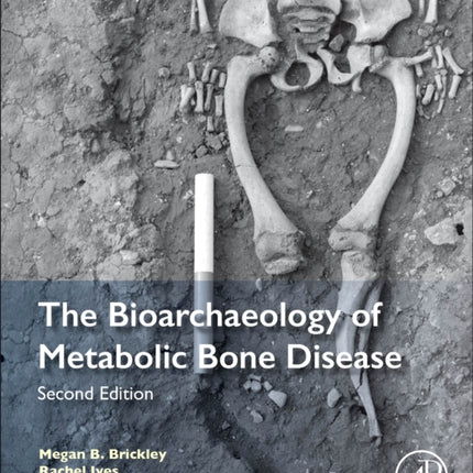 The Bioarchaeology of Metabolic Bone Disease