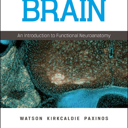 The Brain