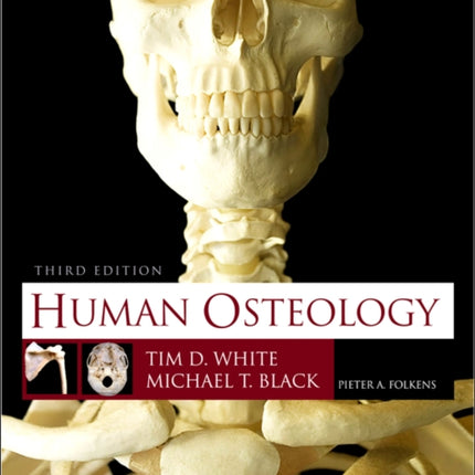 Human Osteology