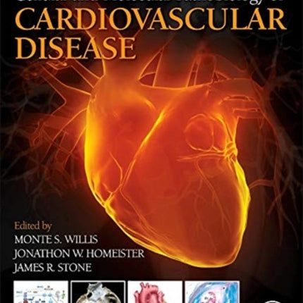 Cellular and Molecular Pathobiology of Cardiovascular Disease