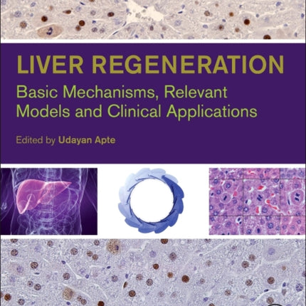 Liver Regeneration