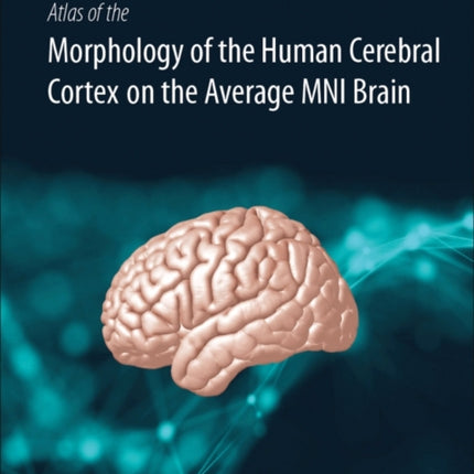 Atlas of the Morphology of the Human Cerebral Cortex on the Average MNI Brain