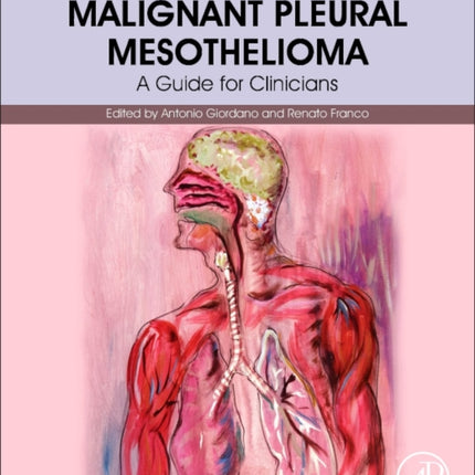 Malignant Pleural Mesothelioma: A Guide for Clinicians