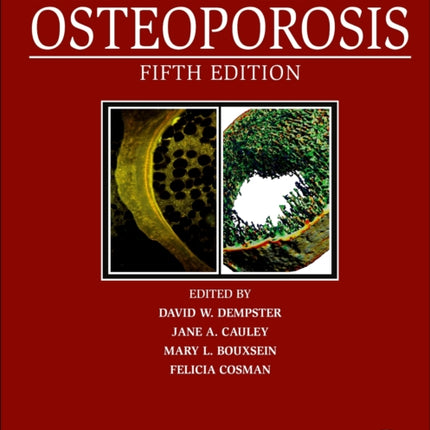 Marcus and Feldmans Osteoporosis