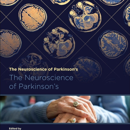 The Neuroscience of Parkinsons Disease