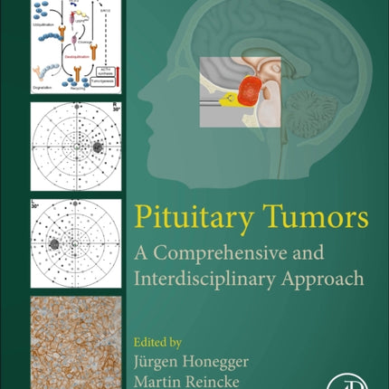 Pituitary Tumors