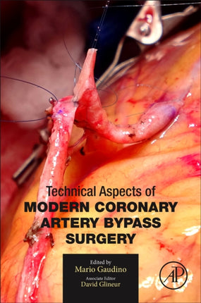 Technical Aspects of Modern Coronary Artery