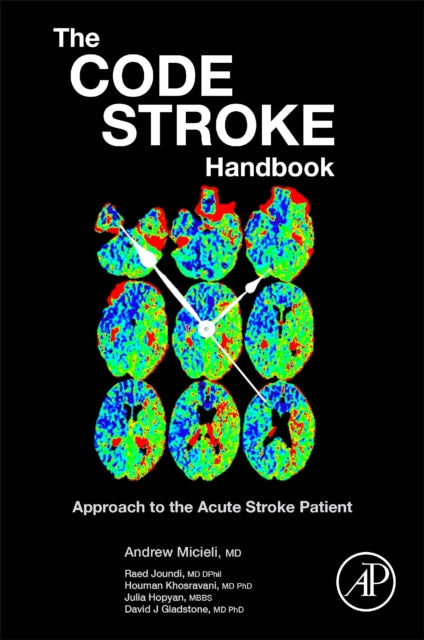 The Code Stroke Handbook: Approach to the Acute Stroke Patient