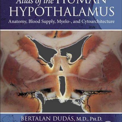 Atlas of the Human Hypothalamus: Anatomy, Blood Supply, Myelo-, and Cytoarchitecture