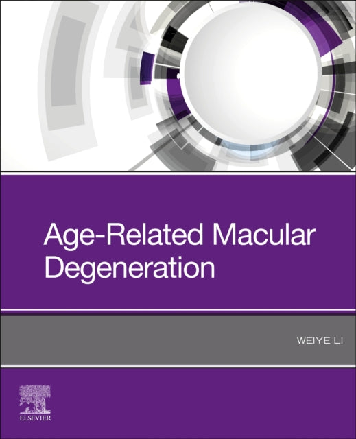 AgeRelated Macular Degeneration