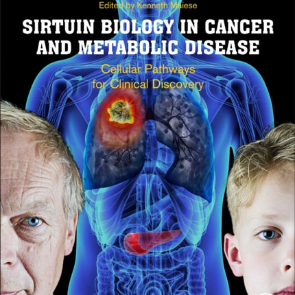 Sirtuin Biology in Cancer and Metabolic Disease