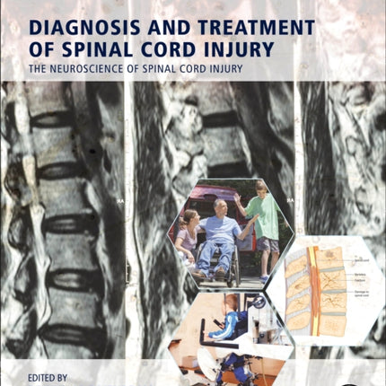 Diagnosis and Treatment of Spinal Cord Injury