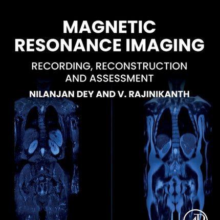 Magnetic Resonance Imaging: Recording, Reconstruction and Assessment