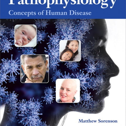 Pathophysiology: Concepts of Human Disease