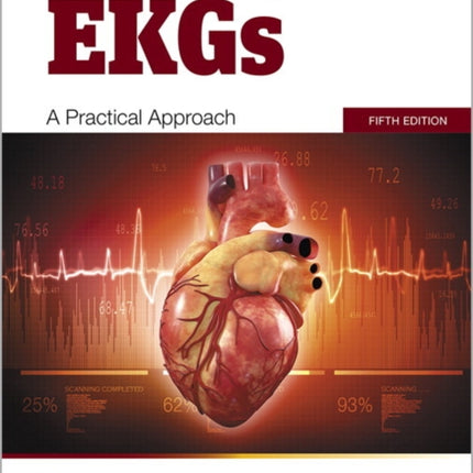 Understanding EKGs: A Practical Approach