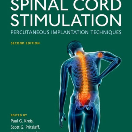 Spinal Cord Stimulation: Percutaneous Implantation Techniques