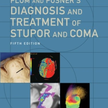 Plum and Posner's Diagnosis and Treatment of Stupor and Coma