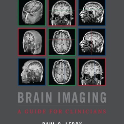 Brain Imaging