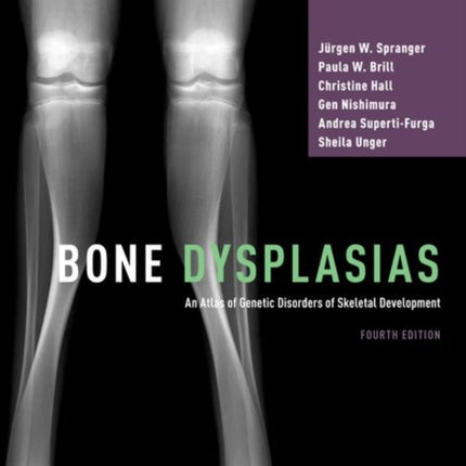 Bone Dysplasias