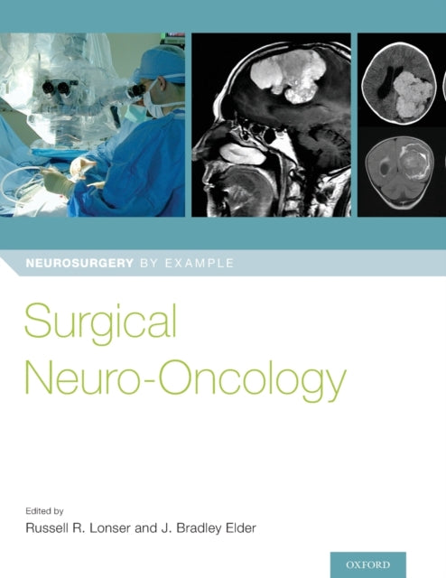 Surgical NeuroOncology Neurosurgery by Example