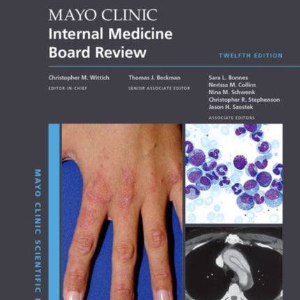 Mayo Clinic Internal Medicine Board Review Mayo
