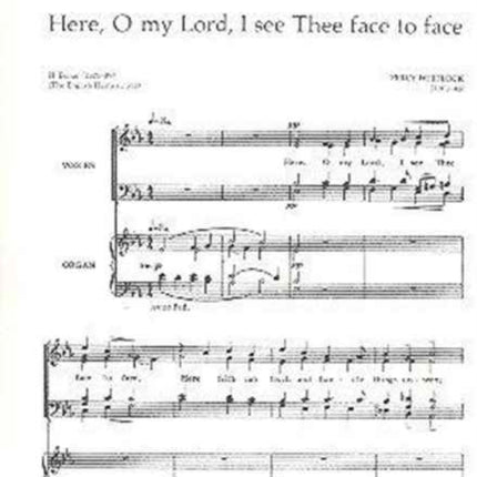 Here O my Lord I see Thee face to face