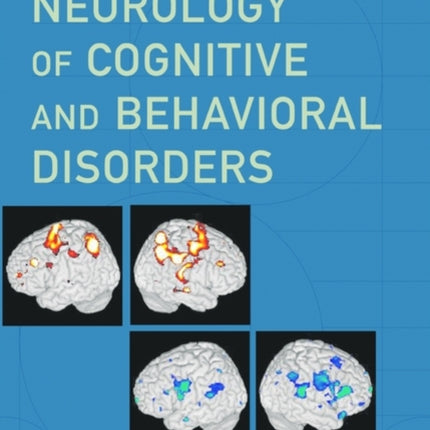 Neurology of Cognitive and Behavioral Disorders