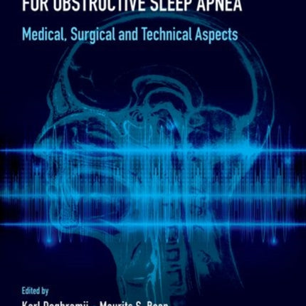 Upper Airway Stimulation Therapy for Obstructive