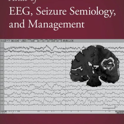 Atlas of EEG, Seizure Semiology, and Management