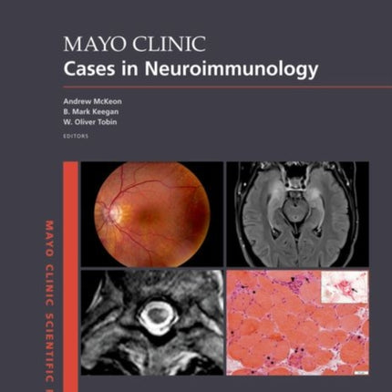 Mayo Clinic Cases in Neuroimmunology Mayo Clinic