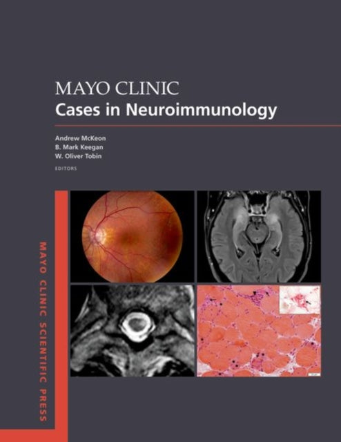 Mayo Clinic Cases in Neuroimmunology Mayo Clinic