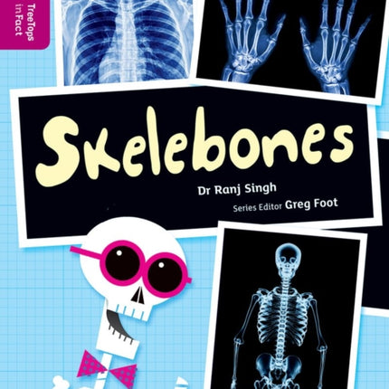 Oxford Reading Tree TreeTops inFact: Level 10: Skelebones