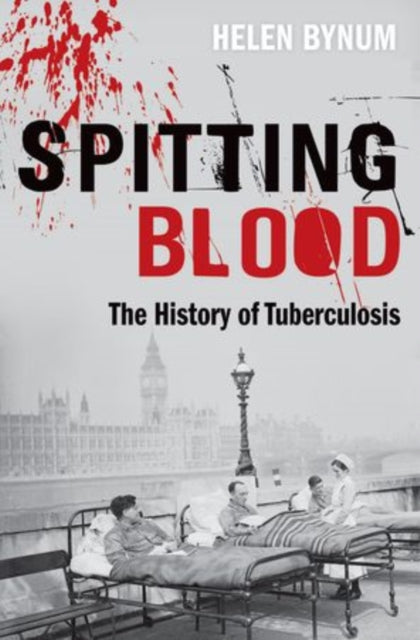 Spitting Blood: The history of tuberculosis