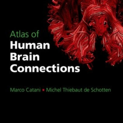 Atlas of Human Brain Connections