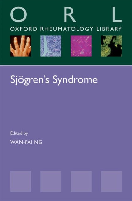 Sjogrens Syndrome