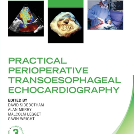 Practical Perioperative Transoesophageal