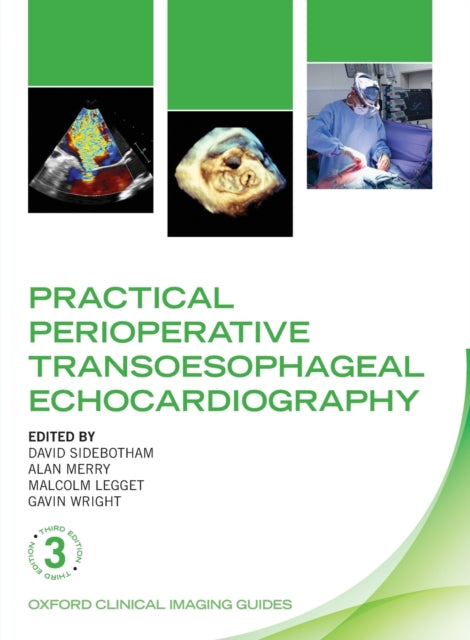 Practical Perioperative Transoesophageal