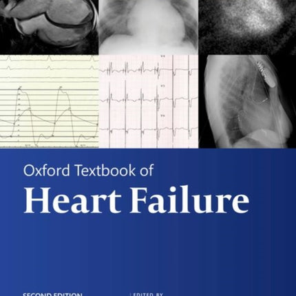 Oxford Textbook of Heart Failure Oxford Textbooks